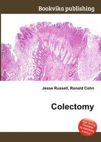 Colectomy