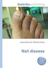 Nail disease