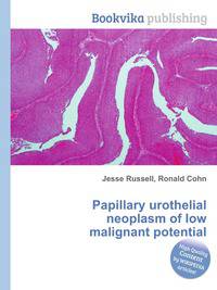 Papillary urothelial neoplasm of low malignant potential