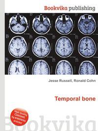 Temporal bone