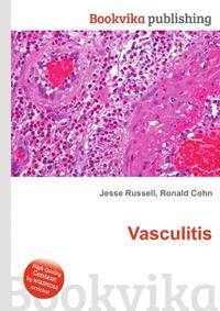 Vasculitis