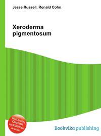 Xeroderma pigmentosum