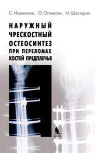 Наружный чрескостный остеосинтез при переломах костей предплечья