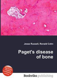 Paget's disease of bone