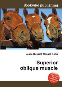 Superior oblique muscle
