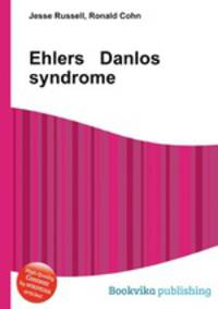 Ehlers Danlos syndrome