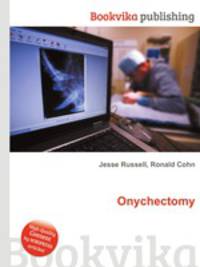 Onychectomy