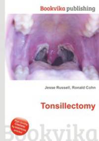 what is tonsillectomy essay View messages from patients providing insights into their medical experiences with tonsillectomy - describe your experience share in the message dialogue to help others and address questions on symptoms, diagnosis, and treatments, from medicinenet's doctors. what is tonsillectomy essay View messages from patients providing insights into their medical experiences with tonsillectomy - describe your experience share in the message dialogue to help others and address questions on symptoms, diagnosis, and treatments, from medicinenet's doctors.