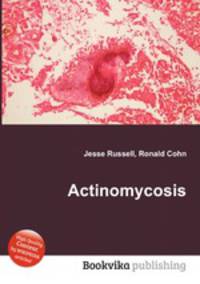 Actinomycosis