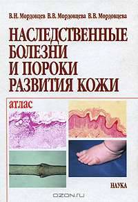 Наследственные болезни и пороки развития кожи. Атлас