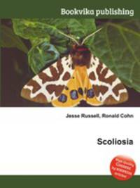 Scoliosia