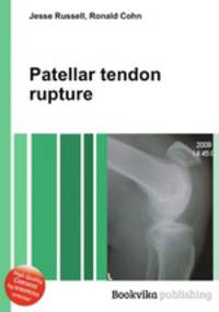 Patellar tendon rupture