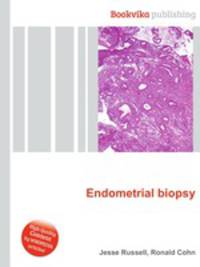 Endometrial biopsy
