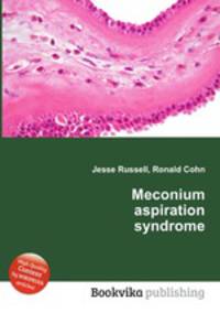 Meconium aspiration syndrome