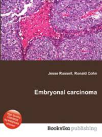 Embryonal carcinoma
