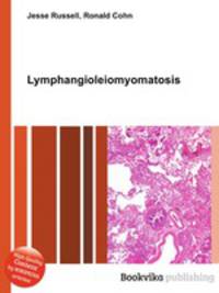 Lymphangioleiomyomatosis