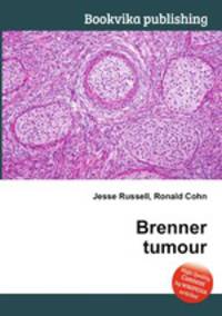 Brenner tumour