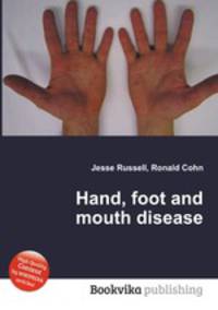 Hand, foot and mouth disease