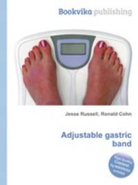 Adjustable gastric band