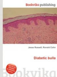 Diabetic bulla