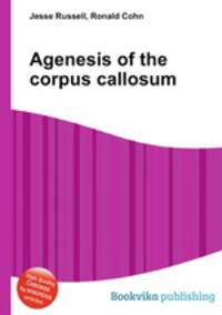 Agenesis of the corpus callosum