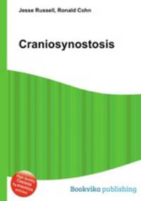 Craniosynostosis