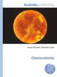 Chorioretinitis