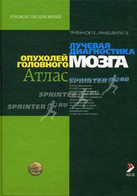 Лучевая диагностика опухолей головного мозга (Атлас КТ и МРТ-изображений): руководство для врачей