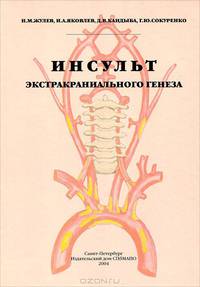 Инсульт экстракраниального генеза