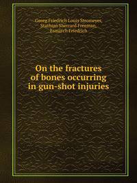 On the fractures of bones occurring in gun-shot injuries