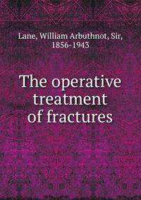 The operative treatment of fractures