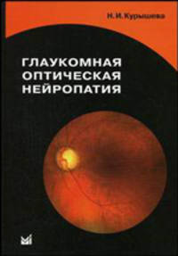 Глаукома оптическая нейропатия: Монография