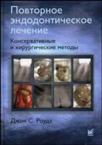 Повторное эндодонтическое лечение. Консервантивные и хирургические методы