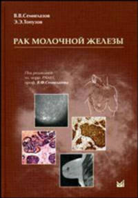 Рак молочной железы