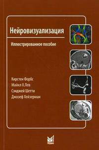 Нейровизуализация. Иллюстрированное пособие