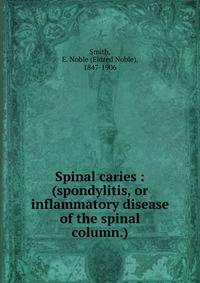 Spinal caries : (spondylitis, or inflammatory disease of the spinal column.)