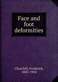 Face and foot deformities