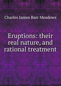 Eruptions: their real nature, and rational treatment