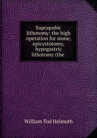 Suprapubic lithotomy: the high operation for stone, epicystotomy, hypogastric lithotomy (the .