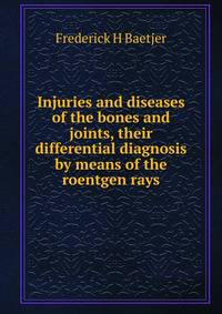 Injuries and diseases of the bones and joints, their differential diagnosis by means of the roentgen rays