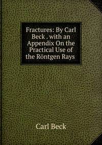 Fractures: By Carl Beck . with an Appendix On the Practical Use of the Rontgen Rays .