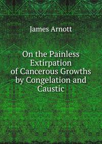 On the Painless Extirpation of Cancerous Growths by Congelation and Caustic