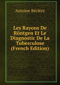 Les Rayons De Rontgen Et Le Diagnostic De La Tuberculose (French Edition)