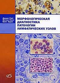 Морфологическая диагностика патологии лимфатических узлов