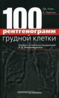 100 рентгенограмм грудной клетки
