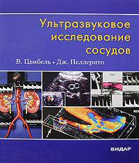 Ультразвуковое исследование сосудов