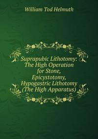 Suprapubic Lithotomy: The High Operation for Stone, Epicystotomy, Hypogastric Lithotomy (The High Apparatus).