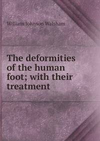 The deformities of the human foot; with their treatment