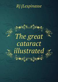 The great cataract illustrated