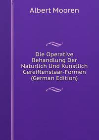 Die Operative Behandlung Der Naturlich Und Kunstlich Gereiftenstaar-Formen (German Edition)